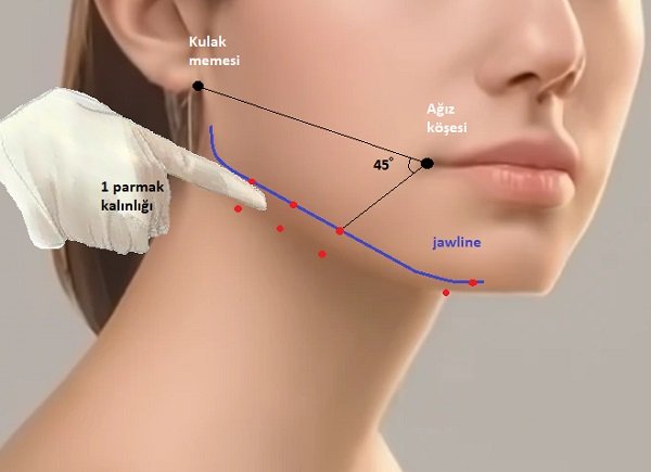 Platysma Botox Fiyatı | WWW İstanbul